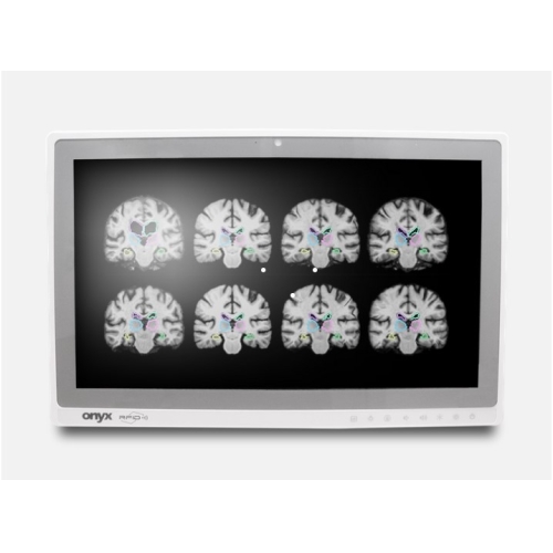 ONYX MATE-2205 22" 8. Generation Intel Core lüfterloser All-In-One Medical Panel PC