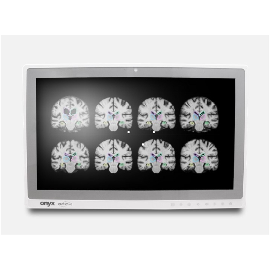 ONYX MATE-2205 22" 8. Generation Intel Core lüfterloser All-In-One Medical Panel PC