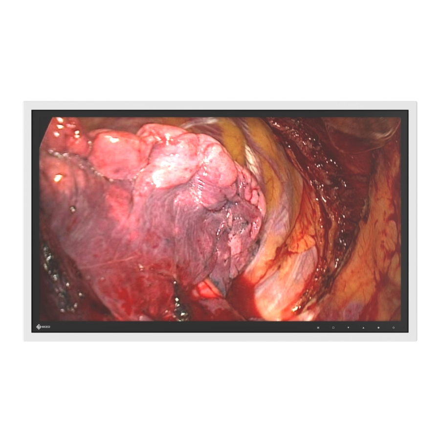 écran chirurgical large LCD Full HD de 27 pouces avec M12 étanche