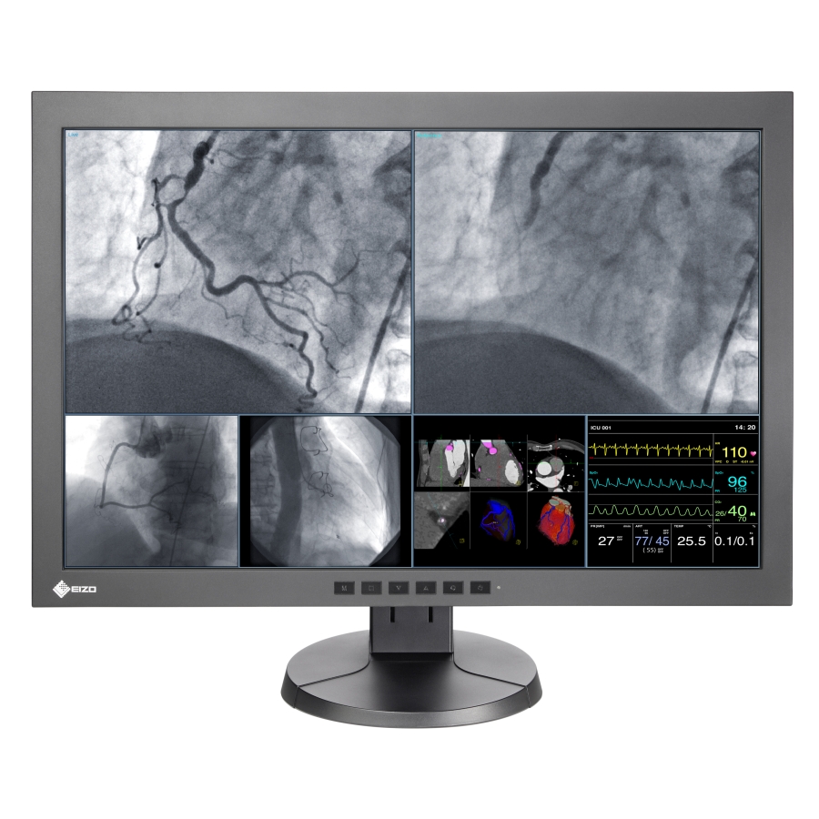 30" LX300W w/Fail-Safe DVI & DICOM Part 14 Compliance