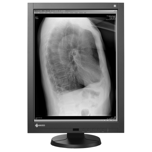 21" 2MP Monochrom-LCD Medizinischer Monitor für CR/DR/MRI/CT/PACS/HIS/RIS