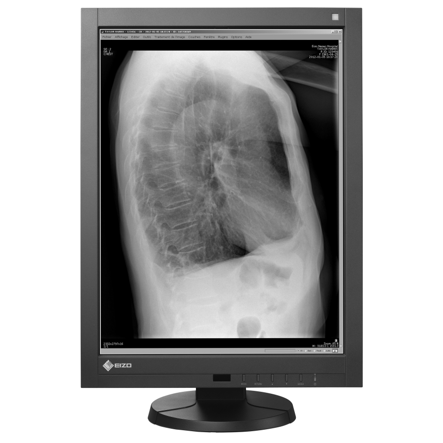 21" 2MP Monochrom-LCD Medizinischer Monitor für CR/DR/MRI/CT/PACS/HIS/RIS