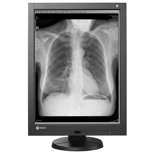 21" hochauflösender diagnostischer Monochrom-Monitor DICOM Teil 14