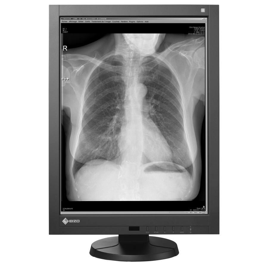 moniteur de diagnostic monochrome haute résolution 21" DICOM Part 14