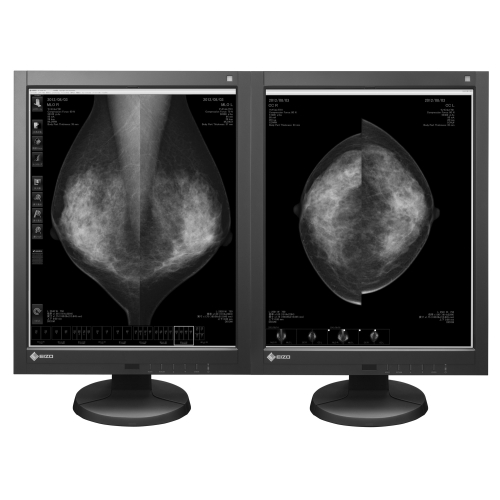21" GX540 LCD Medical Display FDA 510(k) For Tomosynthesis, Mammography & General Radiography