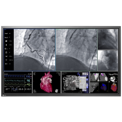 58" Operating Room Monitor w/DUE LS580W DICOM Part 14