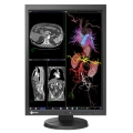 21" Medizinischer Monitor Ideal für MRI & CT DICOM Teil 14