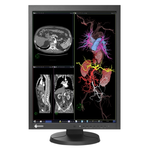 moniteur médical 21" idéal pour IRM et CT DICOM Part 14