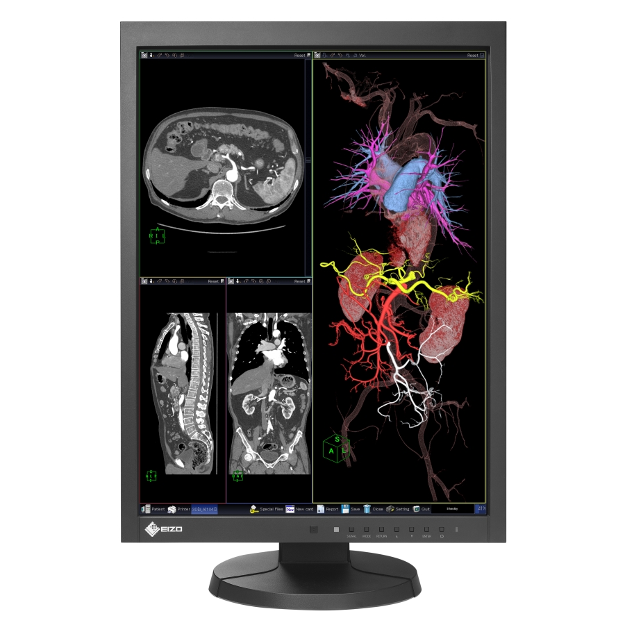 21" Medical Monitor Ideal For MRI & CT DICOM Part 14