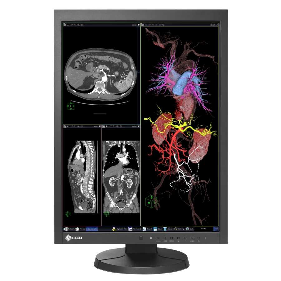 moniteur médical 21" idéal pour IRM et CT DICOM Part 14