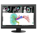 24" Klinisches LCD-Display für medizinische Zwecke DICOM Teil 14