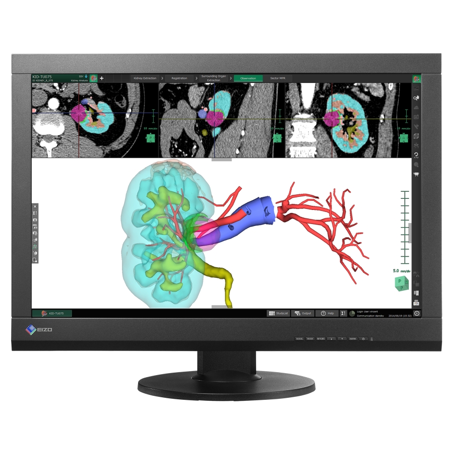24" Clinical LCD Medical Display DICOM Part 14 