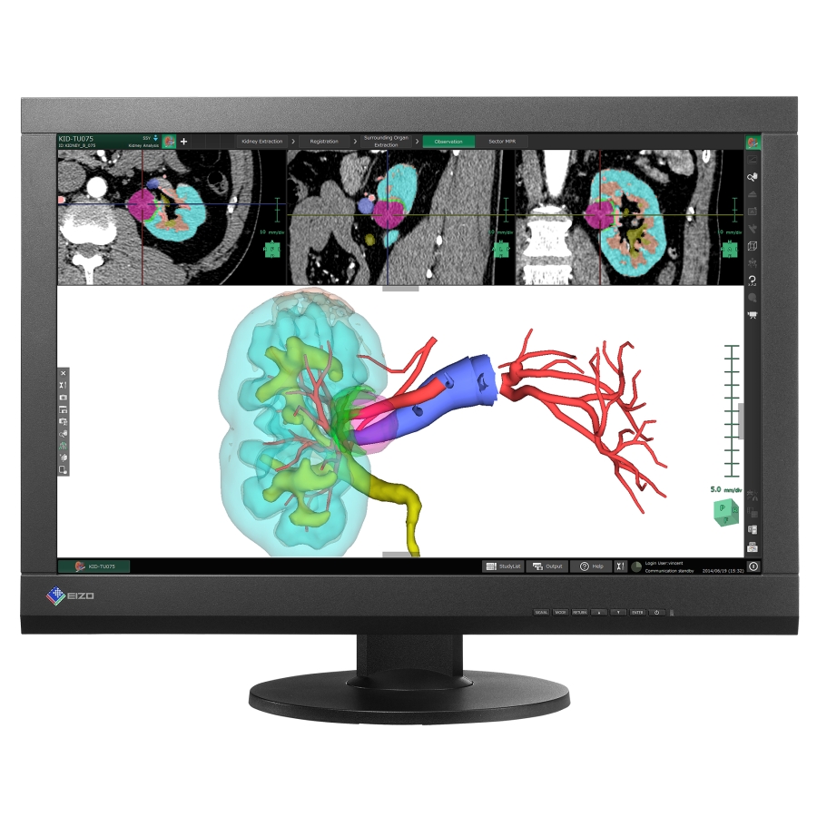 écran médical LCD 24" DICOM Part 14