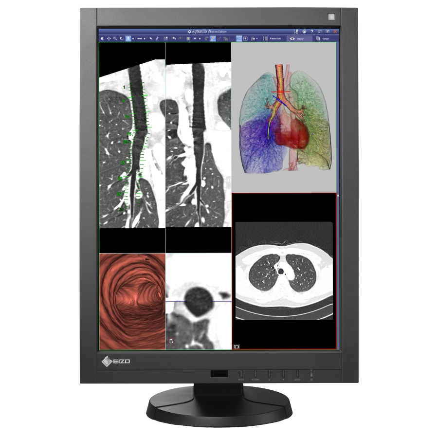 Medizinisches Display RadiForce DICOM Teil 14