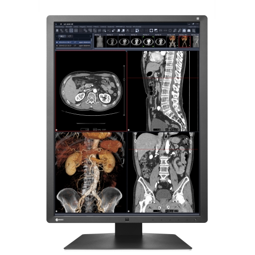 21" Klinischer Slim Monitor 2MP DICOM Teil 14 konform