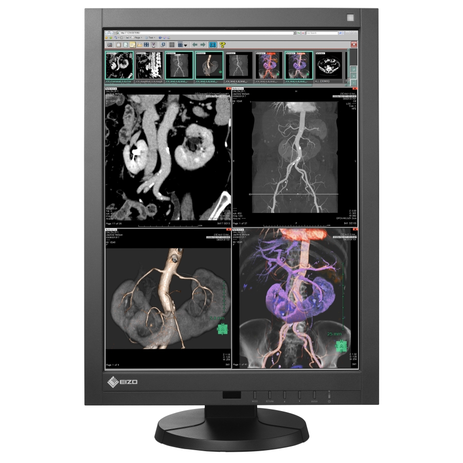 21" RadiForce avec radiographie, CR et DR Compatibilité couleur et monochrome DICOM Part 14