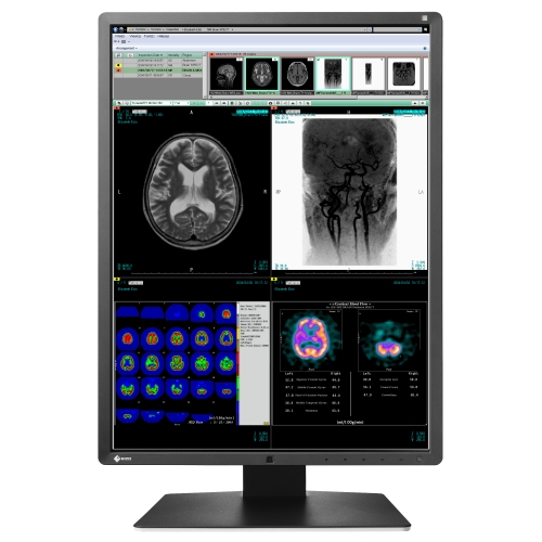 21" RadiForce w/ X-ray, CR & DR Grayscale Compatibility DICOM Part 14