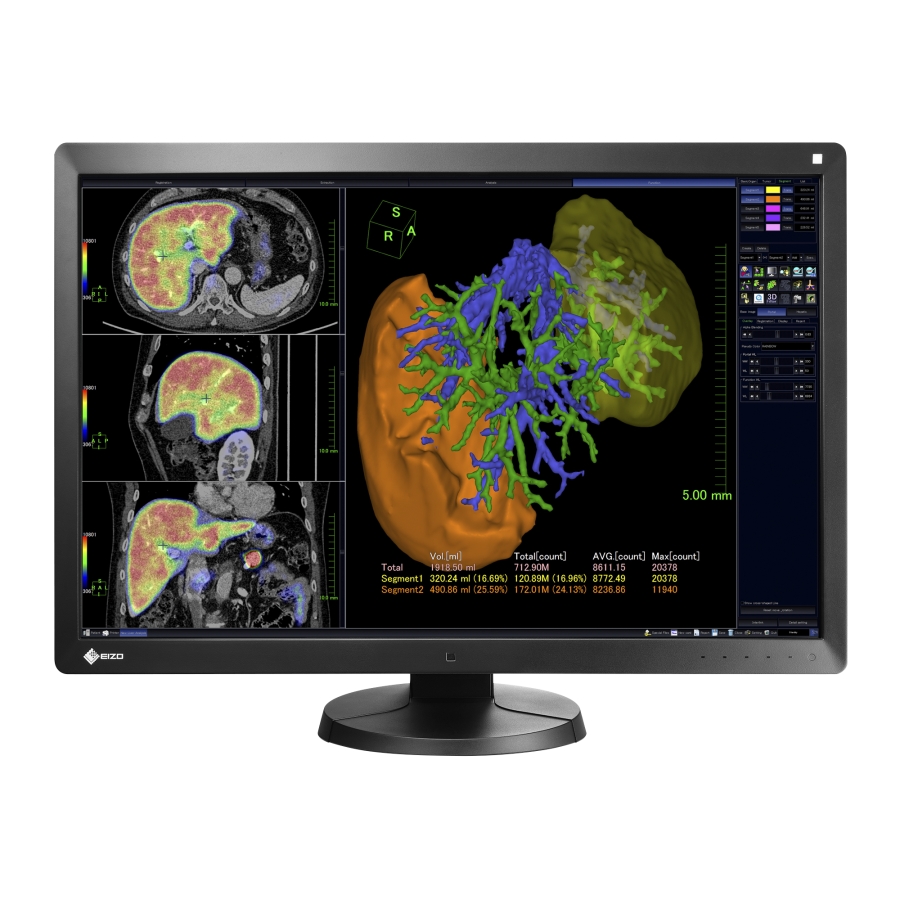 30" 6MP für die medizinische Bildgebung, d. h. CR, DR, CT, MRI und Ultraschall, DICOM Teil 14