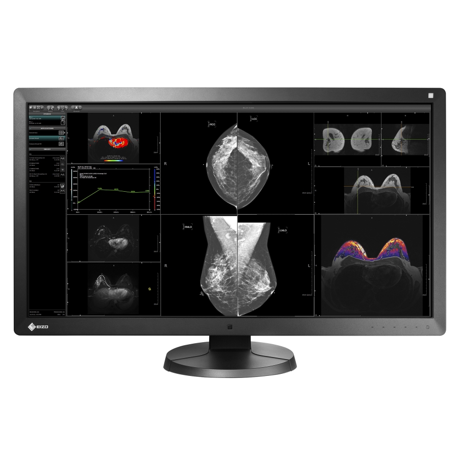 31" RadiForce Multi-Modality Monitor w/PACS